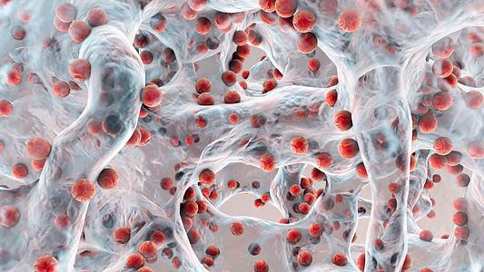 Biofilm of antibiotic resistant spherical bacteria, Staphylococcus aureus, MRSA
